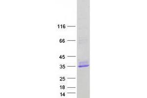 Validation with Western Blot