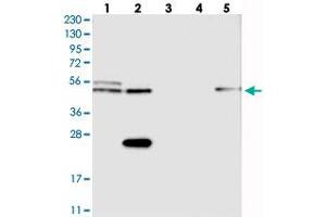 Western blot analysis of Lane 1: RT-4, Lane 2: U-251 MG, Lane 3: Human Plasma, Lane 4: Liver, Lane 5: Tonsil with CDR2L polyclonal antibody  at 1:250-1:500 dilution. (CDR2L 抗体)