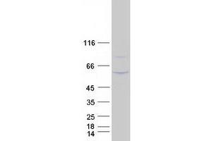 Western Blotting (WB) image for Sialophorin (SPN) (Transcript Variant 2) protein (Myc-DYKDDDDK Tag) (ABIN2713709)