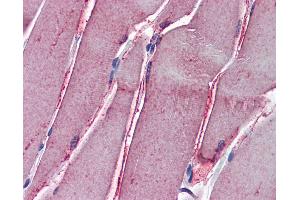 Anti-GSTM2 antibody IHC of human skeletal muscle. (GSTM2 抗体  (AA 90-190))