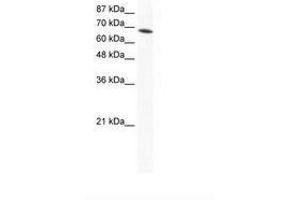 Image no. 1 for anti-DEAD (Asp-Glu-Ala-Asp) Box Polypeptide 1 (DDX1) (AA 671-720) antibody (ABIN202891) (DDX1 抗体  (AA 671-720))