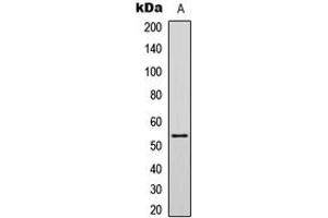 Western blot analysis of p53 (AcK381) expression in HCT116 (A) whole cell lysates. (p53 抗体  (acLys381, C-Term))