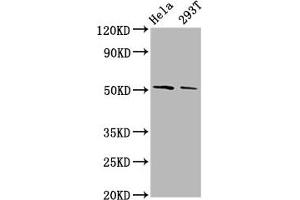 Western Blot Positive WB detected in: Hela whole cell lysate, 293T whole cell lysate All lanes: PLAGL2 antibody at 3. (PLAGL2 抗体  (AA 324-469))
