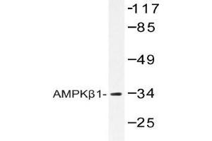 Western blot (WB) analysis of AMPKβ1 antibody in extracts from RAW264. (PRKAB1 抗体)