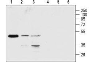 Western blot analysis of rat brain (lanes 1 and 4), Jurkat (lanes 2 and 5) and K-562 (lanes 3 and 6) lysates: - 1-3. (P2RY1 抗体  (2nd Extracellular Loop))