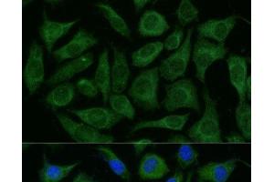 Immunofluorescence analysis of L929 cells using RAPGEF1 Polyclonal Antibody at dilution of 1:100 (40x lens). (GRF2 抗体)