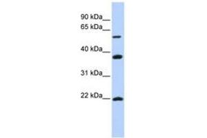Image no. 1 for anti-Myosin Regulatory Light Chain Interacting Protein (MYLIP) (AA 360-409) antibody (ABIN6743161) (MYLIP 抗体  (AA 360-409))