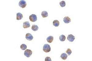 Immunohistochemistry of adiponectin in rat brain tissue with adiponectin antibody at 10 μg/ml. (ADIPOQ 抗体  (C-Term))