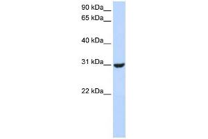 WB Suggested Anti-RNF182 Antibody Titration:  0. (RNF182 抗体  (Middle Region))