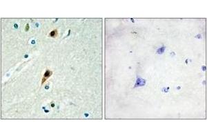 Immunohistochemistry analysis of paraffin-embedded human brain tissue, using RBM5 Antibody. (RBM5 抗体  (AA 226-275))