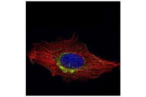 ICC/IF Image Confocal immunofluorescence analysis (Olympus FV10i) of methanol-fixed HeLa, using RAB6A, antibody (Green) at 1:1000 dilution. (RAB6A 抗体)