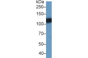 Detection of EPHA4 in Porcine Cerebrum lysate using Polyclonal Antibody to Ephrin Type A Receptor 4 (EPHA4) (EPH Receptor A4 抗体  (AA 621-882))