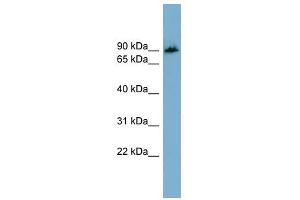 APBB1IP antibody used at 1 ug/ml to detect target protein. (Amyloid beta (A4) Precursor Protein-Binding, Family B, Member 1 Interacting Protein (APBB1IP) (N-Term) 抗体)