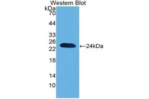 Detection of Recombinant PARK7, Mouse using Polyclonal Antibody to Parkinson Disease Protein 7 (PARK7) (PARK7/DJ1 抗体  (AA 1-189))