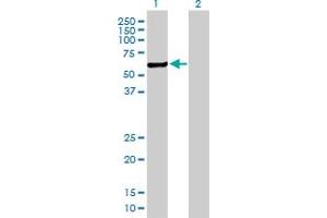 Western Blot analysis of CHKA expression in transfected 293T cell line by CHKA MaxPab polyclonal antibody. (Choline Kinase alpha 抗体  (AA 1-457))