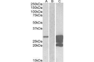 HEK293 lysate (10ug protein in RIPA buffer) overexpressing Human GM2A with DYKDDDDK tag probed with ABIN2562857 (1. (GM2A 抗体  (AA 179-189))