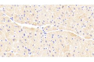 Detection of TNNC1 in Human Cardiac Muscle Tissue using Polyclonal Antibody to Troponin C Type 1, Slow (TNNC1) (TNNC1 抗体  (AA 1-161))