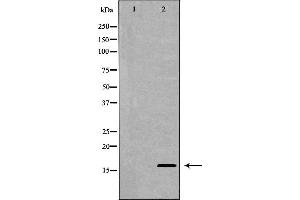 Western blot analysis of extracts of SW480 , using MDK antibody. (Midkine 抗体  (Internal Region))