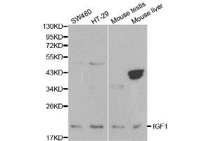 Western blot analysis of extracts of various cell lines, using IGF1 antibody. (IGF1 抗体  (C-Term))