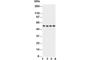 Western blot testing of Glut5 antbody;  Lane 1: U87;  2: 293T;  3: HT1080;  4: SW620 cell lysate (SLC2A5 抗体  (AA 481-501))
