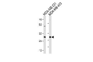 ASB11 Antibody (N-term) (ABIN1881072 and ABIN2843226) western blot analysis in MDA-MB-231,MDA-MB-453 cell line lysates (35 μg/lane). (ASB11 抗体  (N-Term))