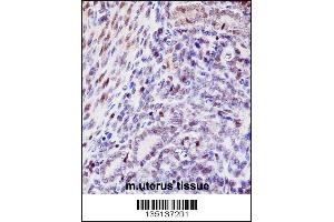 Mouse Hoxd10 Antibody immunohistochemistry analysis in formalin fixed and paraffin embedded mouse uterus tissue followed by peroxidase conjugation of the secondary antibody and DAB staining. (HOXD10 抗体  (AA 201-230))