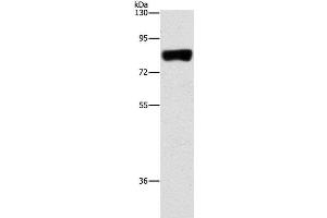 Western Blot analysis of Hela cell using ARHGAP25 Polyclonal Antibody at dilution of 1:500 (ARHGAP25 抗体)