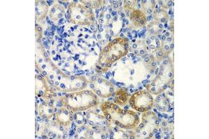 Immunohistochemistry of paraffin-embedded rat kidney using DCTD antibody  at dilution of 1:200 (40x lens). (DCMP Deaminase (DCTD) (AA 1-178) 抗体)