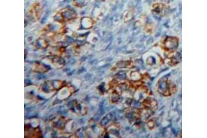 Used in DAB staining on fromalin fixed paraffin-embedded Ovary tissue (CD83 抗体  (AA 24-205))