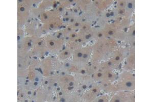 Used in DAB staining on fromalin fixed paraffin- embedded liver tissue (PANK1 抗体  (AA 298-500))