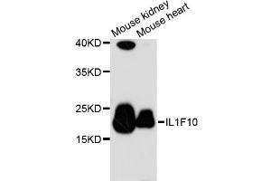 Western blot analysis of extracts of various cell lines, using IL1F10 antibody (ABIN6293249) at 1:3000 dilution. (IL1F10 抗体)