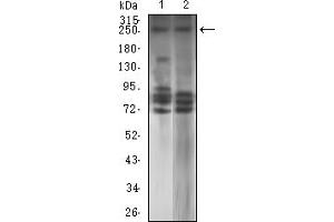 Western Blotting (WB) image for anti-Tet Methylcytosine Dioxygenase 2 (TET2) antibody (ABIN7193624)
