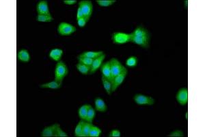 Immunofluorescence staining of HepG2 cells with ABIN7168353 at 1:33, counter-stained with DAPI. (RBM45 抗体  (AA 170-244))