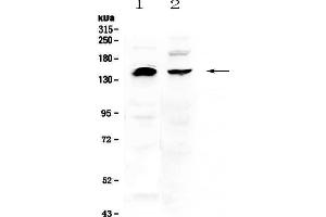 Western blot analysis of NEDD4 using anti-NEDD4 antibody . (NEDD4 抗体  (AA 960-1245))