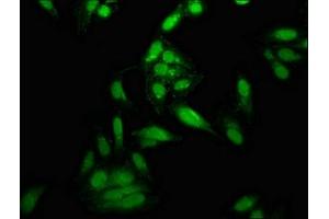 Immunofluorescence staining of Hela cells with ABIN7150342 at 1:166, counter-stained with DAPI. (Topoisomerase I 抗体  (AA 358-501))