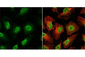 ICC/IF Image O-GlcNAc transferase antibody detects O-GlcNAc transferase protein at nucleus by immunofluorescent analysis. (OGT 抗体)