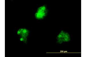 Immunofluorescence of monoclonal antibody to KHDRBS1 on A-431 cell. (KHDRBS1 抗体  (AA 176-275))