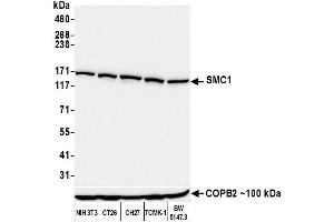 Western Blotting (WB) image for anti-Structural Maintenance of Chromosomes 1A (SMC1A) (C-Term) antibody (ABIN7455193)
