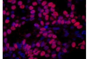 Immunofluorescence (IF) image for anti-High Mobility Group Nucleosome Binding Domain 1 (HMGN1) (AA 90-100) antibody (ABIN7448975)