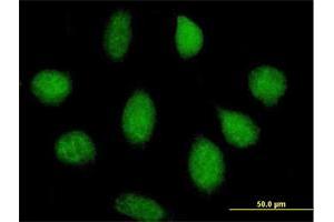 Immunofluorescence of purified MaxPab antibody to KIAA0157 on HeLa cell. (FAM175B 抗体  (AA 1-311))