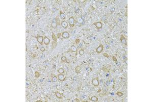 Immunohistochemistry of paraffin-embedded Mouse brain using MTNR1A antibody (ABIN6128254, ABIN6144165, ABIN6144166 and ABIN6216865) at dilution of 1:100 (40x lens). (Melatonin Receptor 1A 抗体  (AA 281-350))