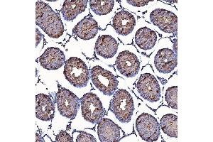 anti-Translocase of Outer Mitochondrial Membrane 34 (TOMM34) (AA 1-309) antibody