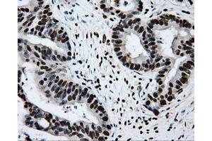 Image no. 1 for anti-Replication Protein A2, 32kDa (RPA2) antibody (ABIN1500733) (RPA2 抗体)