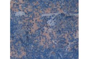 Immunohistochemistry (IHC) image for anti-Killer Cell Lectin-Like Receptor Subfamily K, Member 1 (KLRK1) (AA 90-232) antibody (ABIN7444355)