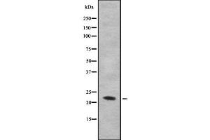 Western blot analysis IL28B using HuvEc whole cell lysates (IL28B 抗体)