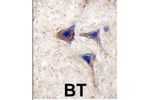 Formalin-fixed and paraffin-embedded human brain tissue reacted with BRAF Antibody , which was peroxidase-conjugated to the secondary antibody, followed by DAB staining. (SNRPE 抗体  (AA 424-453))