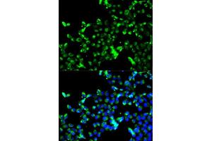 Immunofluorescence analysis of A549 cell using CALR antibody. (Calreticulin 抗体)