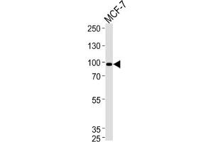 Western Blotting (WB) image for anti-Collagen, Type IX, alpha 1 (COL9A1) antibody (ABIN3001615) (COL9A1 抗体)
