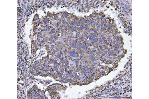 IHC analysis of ATP5F1B using anti-ATP5F1B antibody (ABIN7599866). (Atp5f1b (AA 123-529) 抗体)