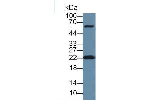 Western Blot; Sample: Human Hela cell lysate; Primary Ab: 1µg/ml Rabbit Anti-Human DTYMK Antibody Second Ab: 0. (DTYMK 抗体  (AA 43-190))